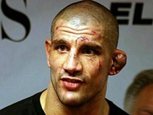 ufc fighters ears puffy