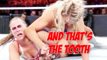 Ronda Rousey tooth