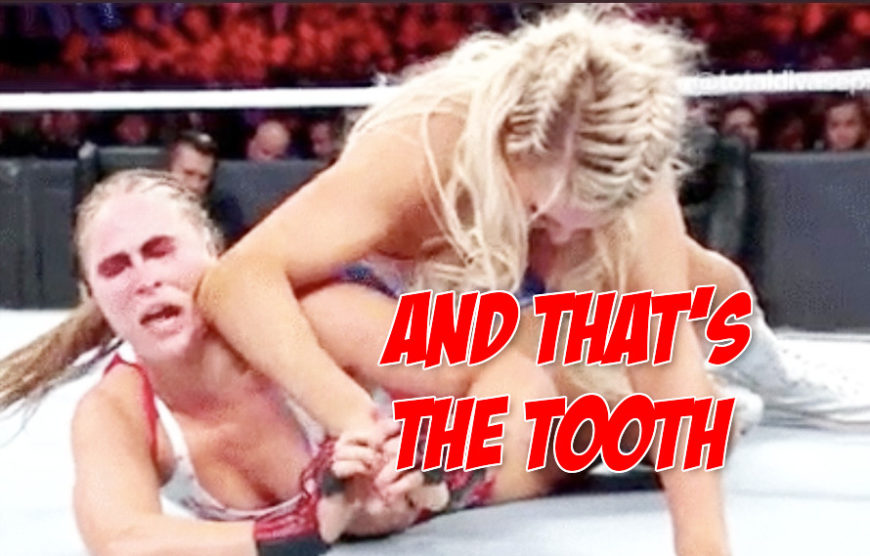 Ronda Rousey tooth