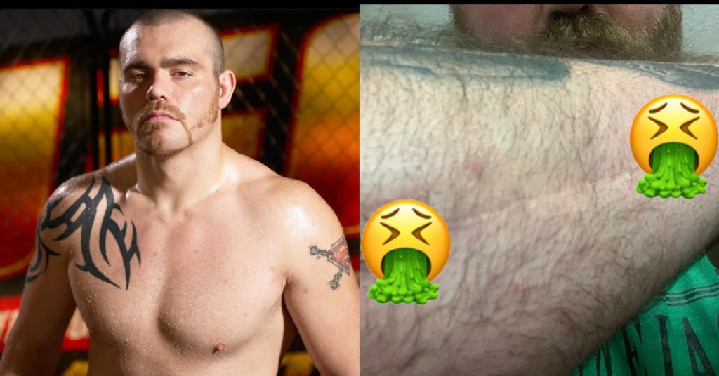 Tim Sylvia Asks UFC’s Help For Lingering Broken Arm Issues From 2004 Frank Mir Fight