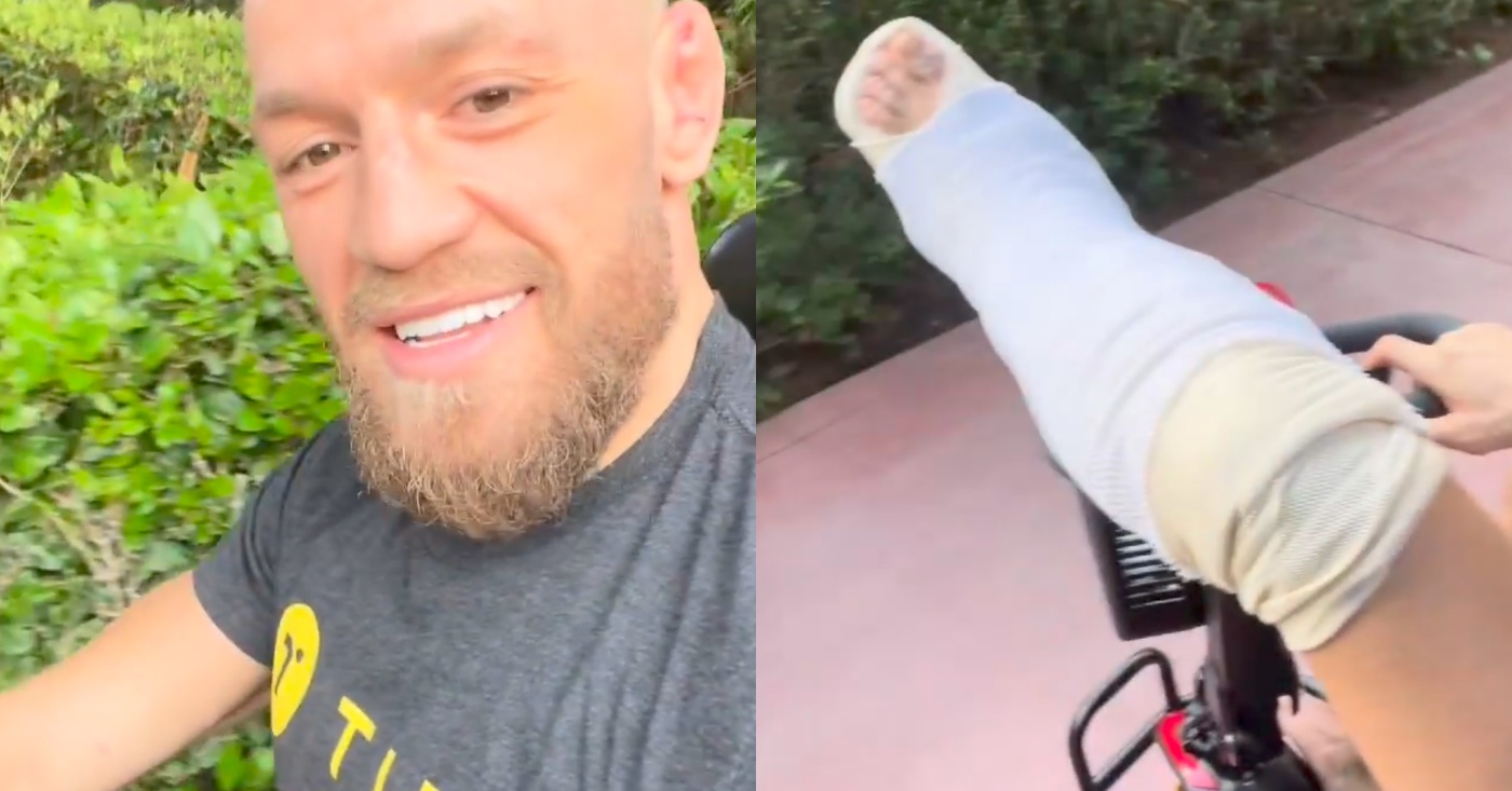 conor mcgregor leg toy