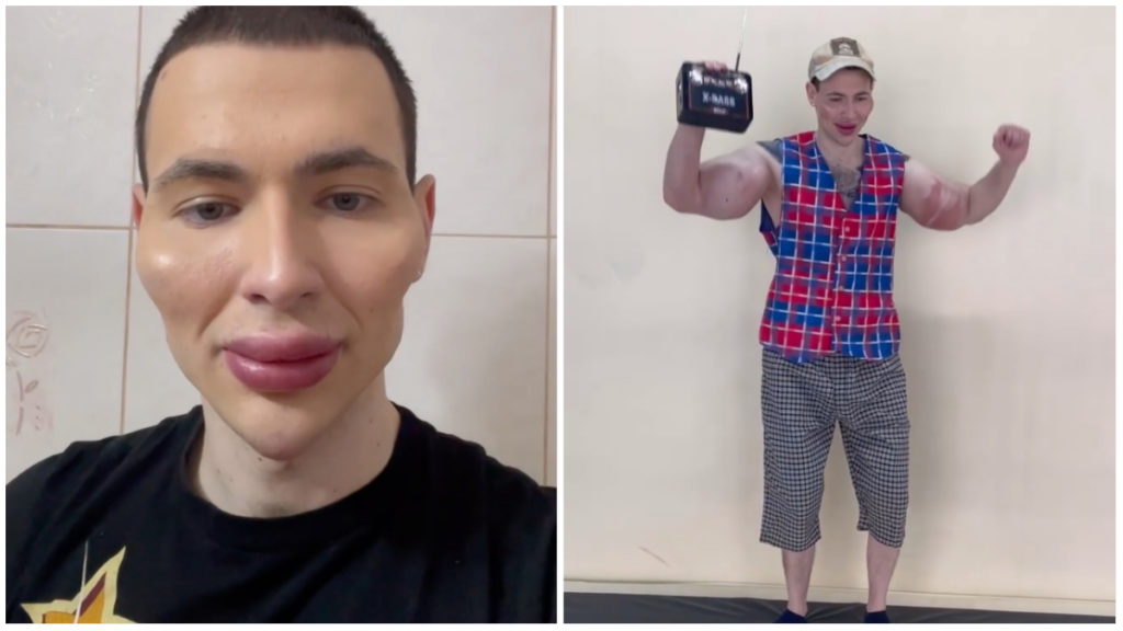 Video 'Russian Popeye' Who Lost MMA Fight To Man 20 Years Older Might