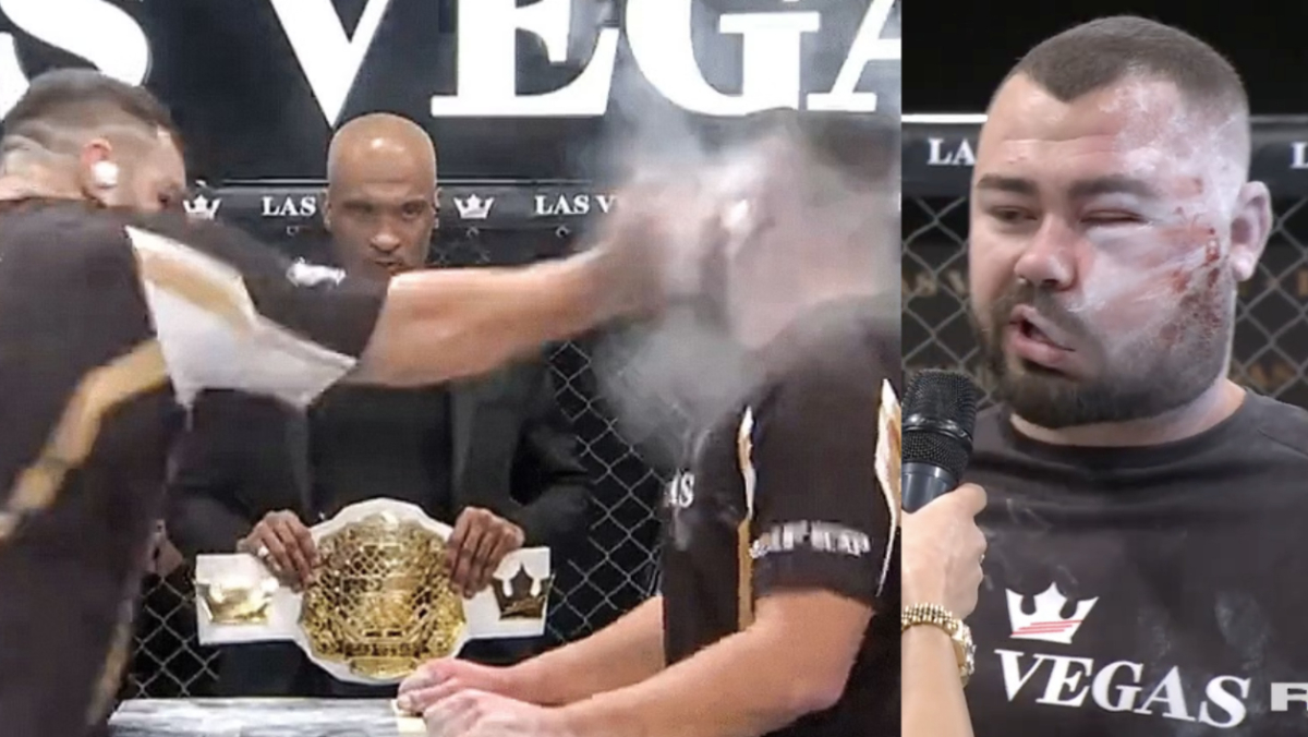 Watch Slap Fighter's Face Left Deformed After Savage Strike, Wins The