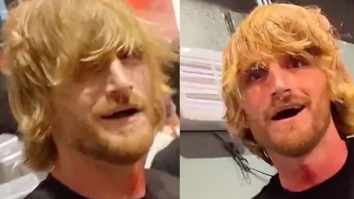 Logan Paul Lookalike Claims Brutal Attack By Nate Diaz Swears Revenge After Showing Gruesome 9932