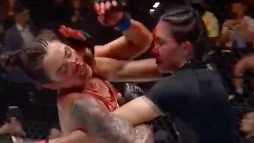 Irene Aldana’s Face Gash After Ufc 306