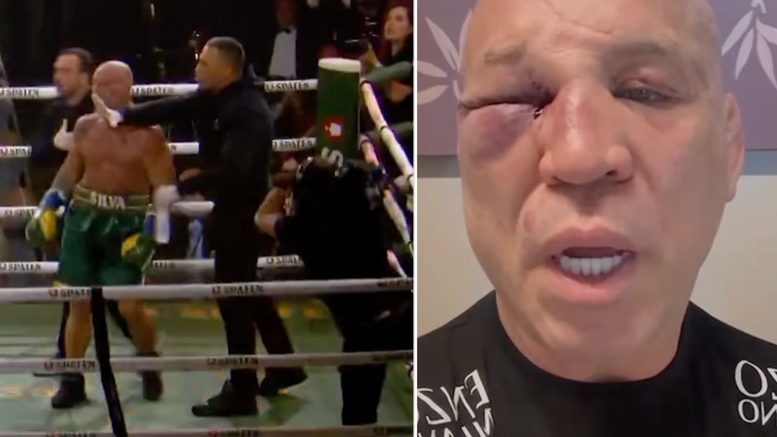 Wanderlei Silva Speaks Out After Being Knocked Out in Post-Fight Brawl: ‘I Was Cowardly Assaulted’
