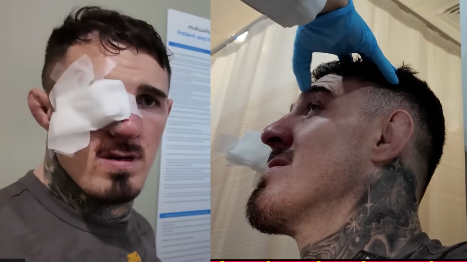 Tom Aspinall Says 'All That Training for That' After UFC 321 Eye Poke,  Shares Hospital Visit and Eye Exam Details | MiddleEasy