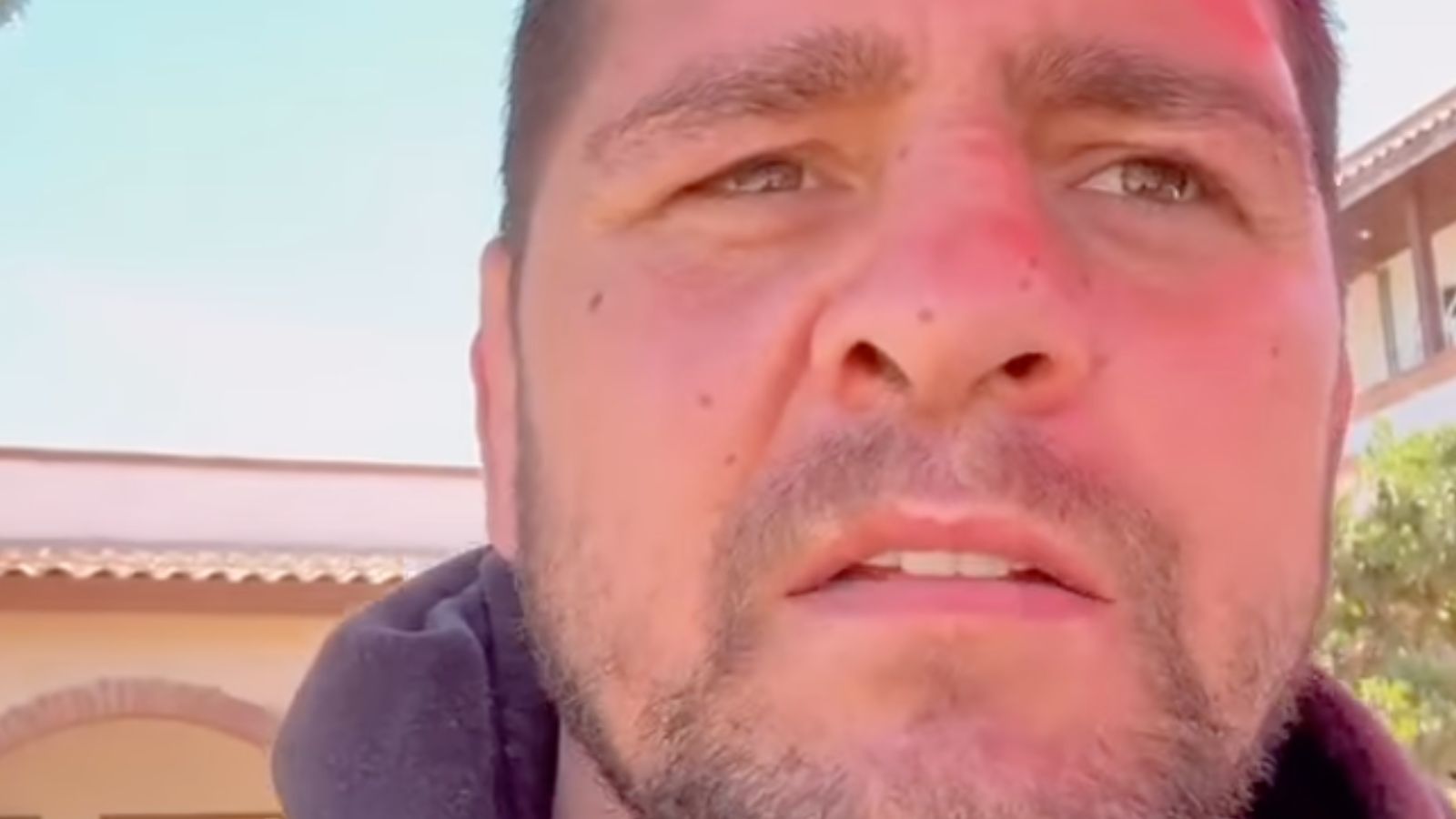 Nick Diaz Confirms Recovery Progress From Mexican Rehab, Tells Fans 'Coming Home Soon"