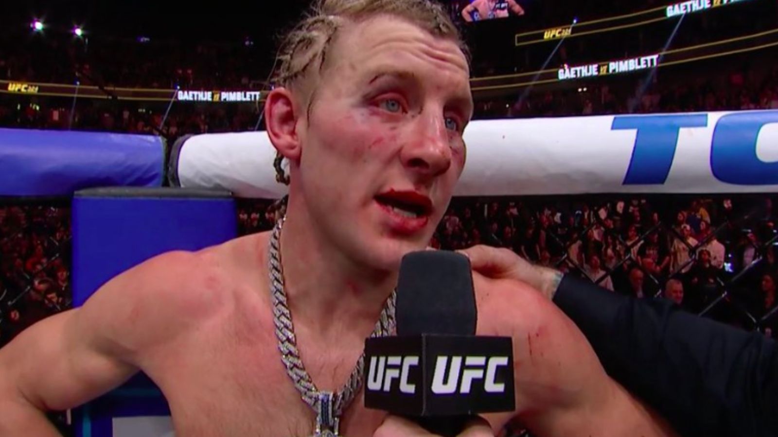 Dana White Shows Paddy Pimblett’s Battle-Scarred Face After Justin Gaethje Defeat At UFC 324