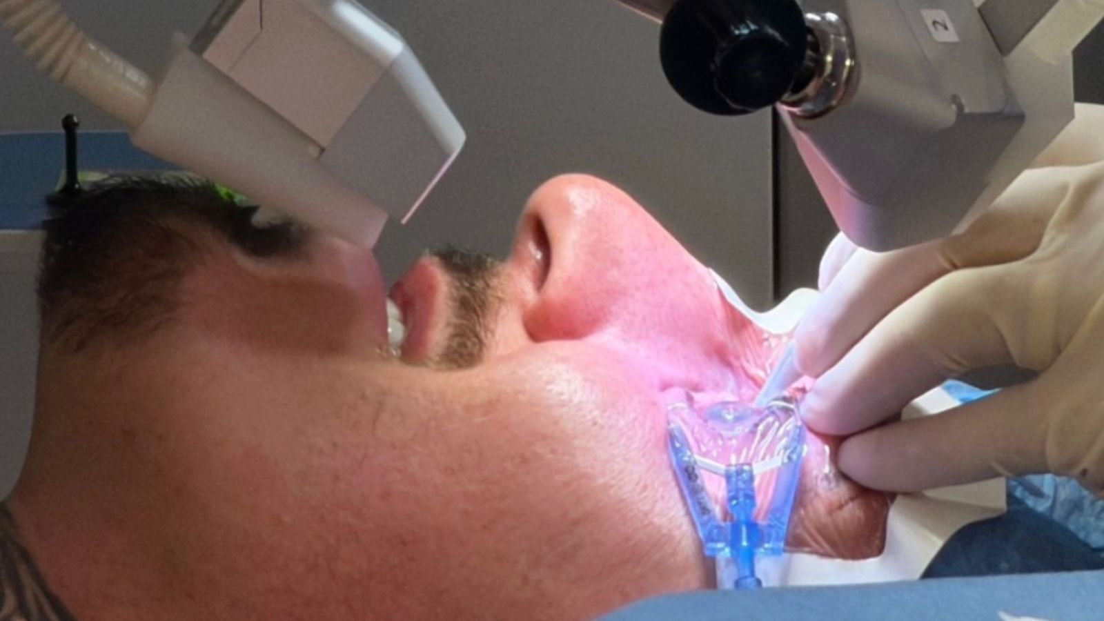 Tom Aspinall Has Surgery on Both Eyes, Doctors Focus on Restoring His Vision for Back to Fighting Fitness