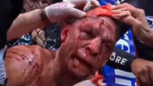Nate Diaz