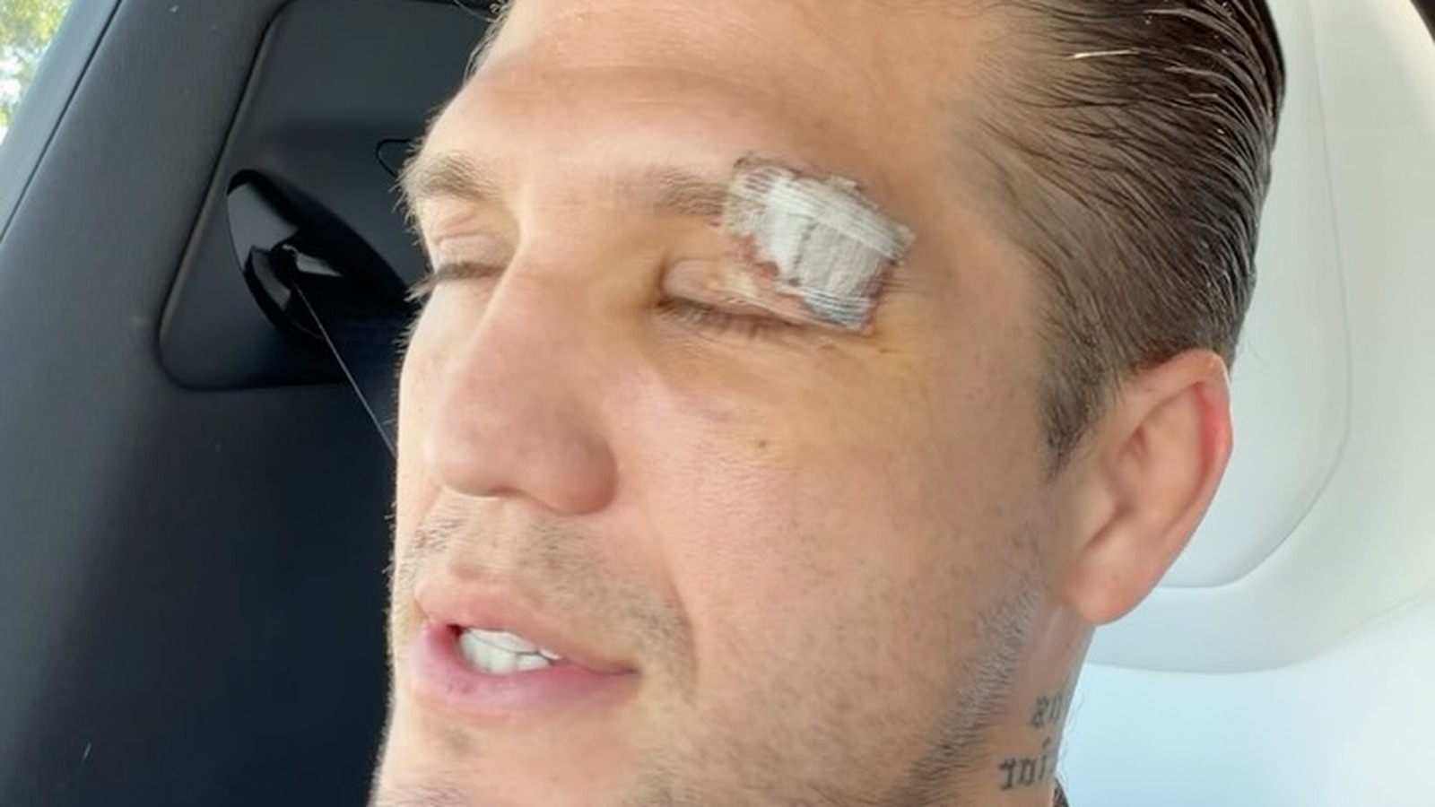 Brian Ortega Apologizes After UFC 331 Withdrawal, Explains Eye Cut